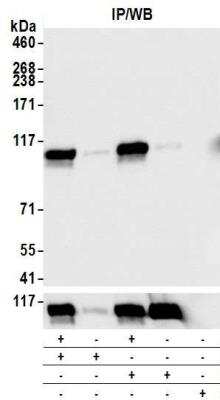 Immunoprecipitation: KAP1 [p Ser824] Antibody [NB100-2350]